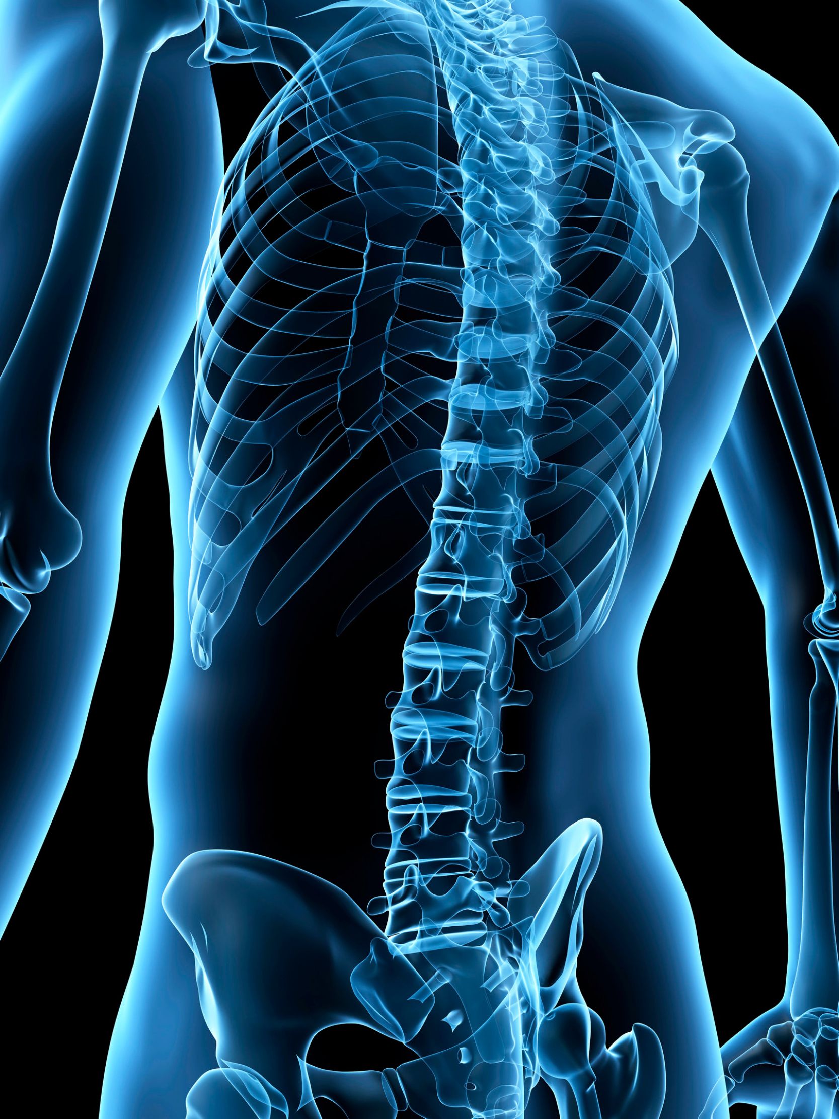 Back-Pain-Treatment-Program